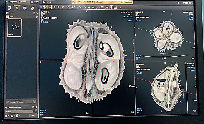  ARDA โชว์ความเป็นเจ้าแห่งบัลลังก์ราชาหนาม  สร้างเครื่อง CT-Scan ทุเรียนสุดล้ำ ประมวลผลด้วยระบบ AI คัดทุเรียน “ไม่อ่อน-ไม่หนอน” 1 ลูกใช้เวลาสแกน 3 วินาที 